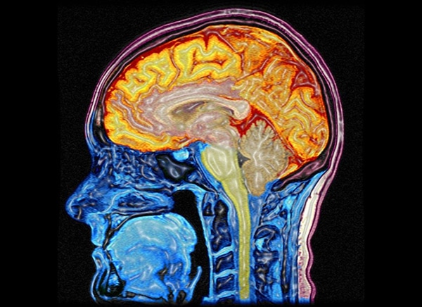 brain-virus-can-decrease-intelligence