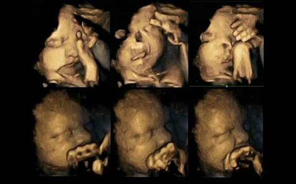 Babies in The Womb Usually Cry Not Because They Are Upset.